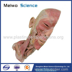 Superficial vascular nerve of head and neck medical specimen plastination