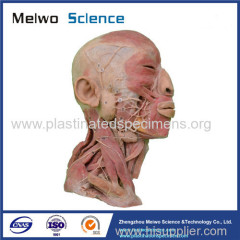 Superficial vascular nerve of head and neck medical specimen plastination