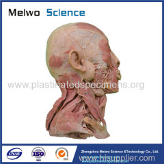 Superficial vascular nerve of head and neck medical specimen plastination