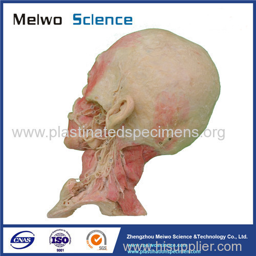 Deep vascular nerve of head and neck plastination