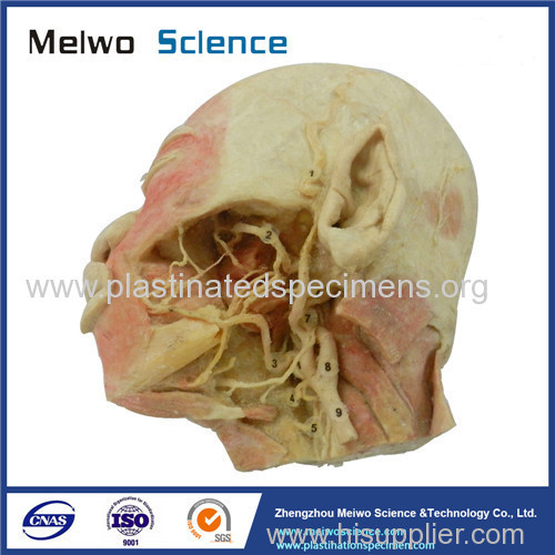 Deep vascular nerve of head and face plastinated specimen