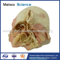 Deep vascular nerve of head and face plastinated specimen