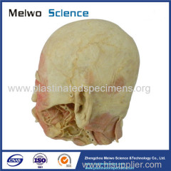 Deep vascular nerve of head and face plastinated specimen