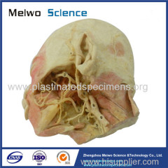 Deep vascular nerve of head and face plastinated specimen