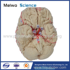 Human artery of whole brain plastinated specimen