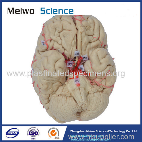 Human artery of whole brain plastinated specimen