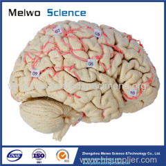 Human artery of whole brain plastinated specimen