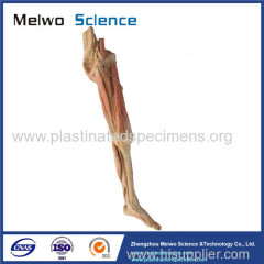 Superficial vein and nerve of lower limb plastinated specimen