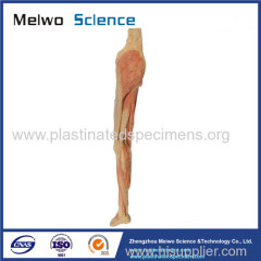 Superficial vein and nerve of lower limb plastinated specimen