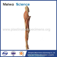 Superficial vein and nerve of lower limb plastinated specimen