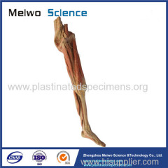 Superficial vein and nerve of lower limb plastinated specimen