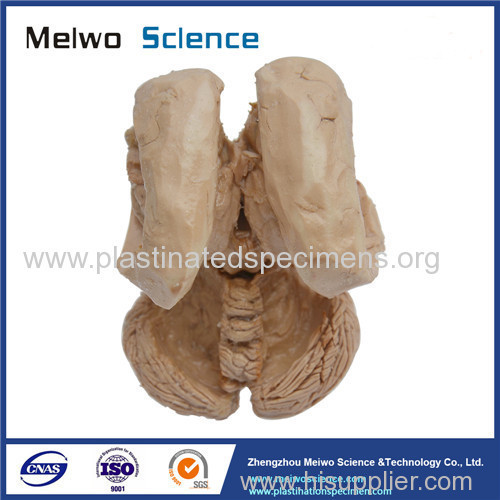 Human brain stem and cerebellum plastinated specimen