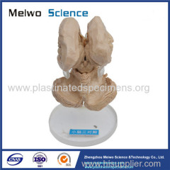 Human brain stem and cerebellum plastinated specimen