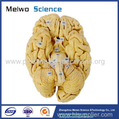 Human whole brain plastination specimen