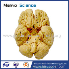 Human whole brain plastination specimen