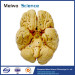 Human whole brain plastination specimen