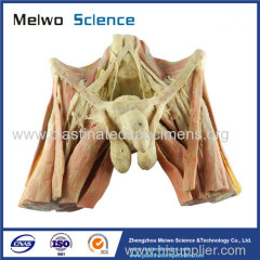 Male pelvic organs plastinated specimen