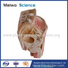 Sagittal section of male pelvic plastinated specimen