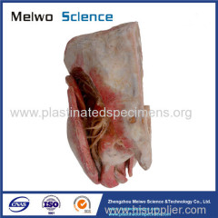 Sagittal section of male pelvic plastinated specimen