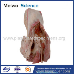 Sagittal section of male pelvic plastinated specimen