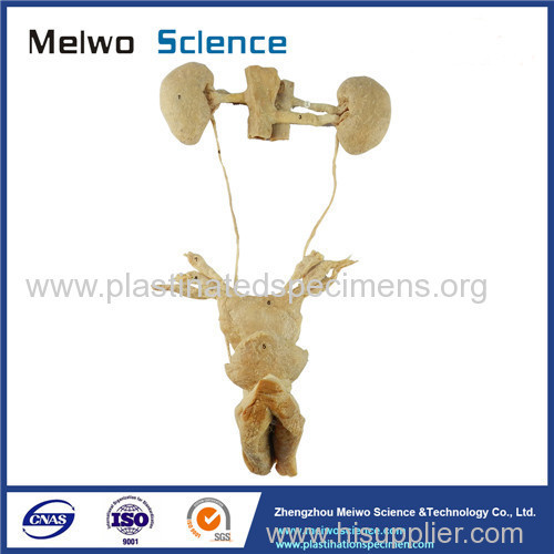 Female urogenital system plastination