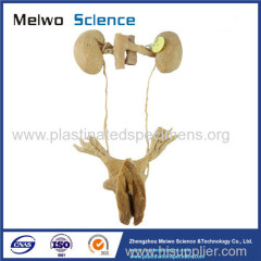 Female urogenital system plastination