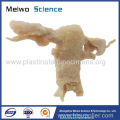 Female internal genital organs anatomic specimen