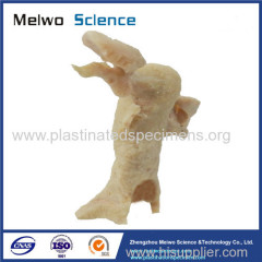 Female internal genital organs anatomic specimen