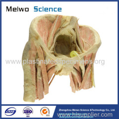 Female pelvic organs human body plastination