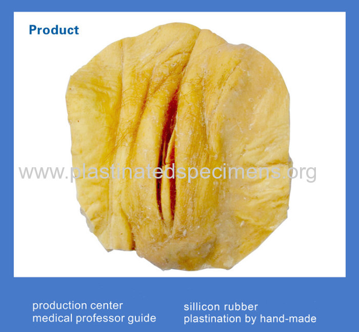 Female pudenda plastinated specimen MWUG-011 manufacturer from China