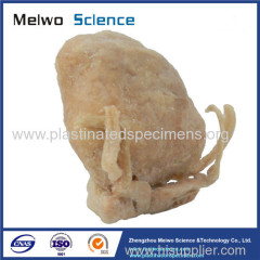 Prostate seminal vescle bladder plastinated specimen