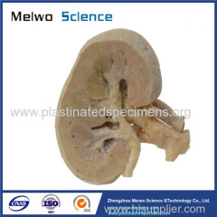 Coronal section of kidney plastinated specimen