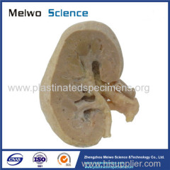 Coronal section of kidney plastinated specimen