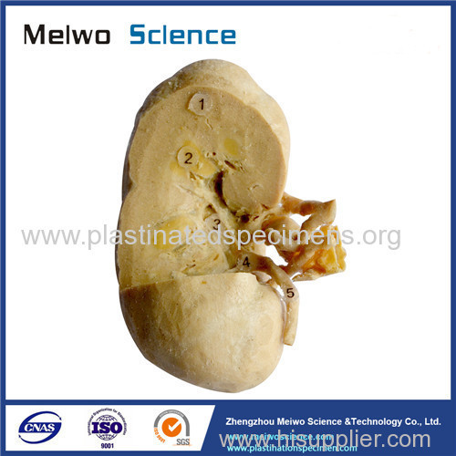 Coronal section of kidney 3 quaters plastination