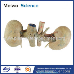 Double kidney plastination specimen for sale