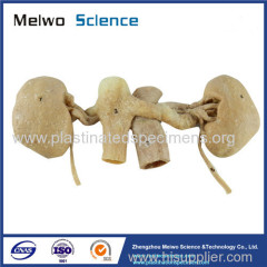 Double kidney plastination specimen for sale