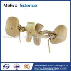 Double kidney plastination specimen for sale