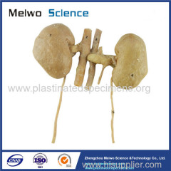 Double kidney plastination specimen for sale