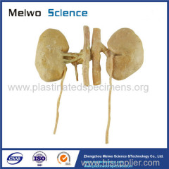 Double kidney plastination specimen for sale