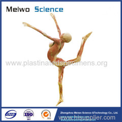 Dance lady plastinated specimen