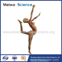 Dance lady plastinated specimen