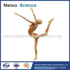 Dance lady plastinated specimen