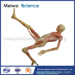 Human hang upside plastinated specimen