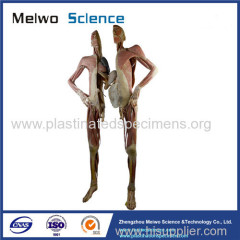 Divided people medical specimen plastination