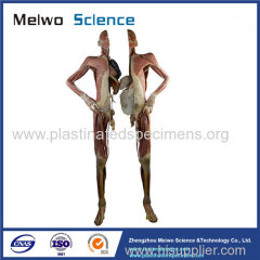 Divided people medical specimen plastination