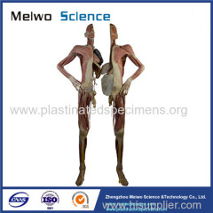 Divided people medical specimen plastination