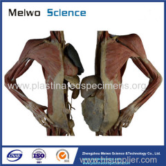 Divided people medical specimen plastination