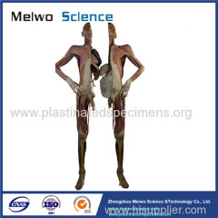 Divided people medical specimen plastination