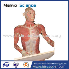 Medical drawing plastinated specimen