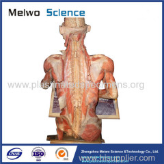 Medical drawing plastinated specimen